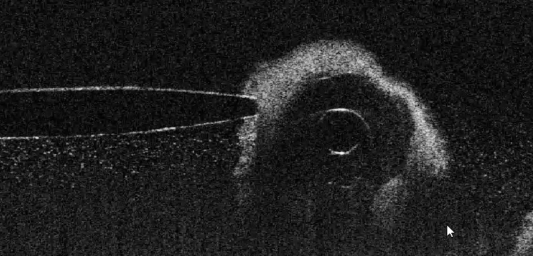 Biofilm auf Hohlfaser der mit einem Sensor beprobt wird